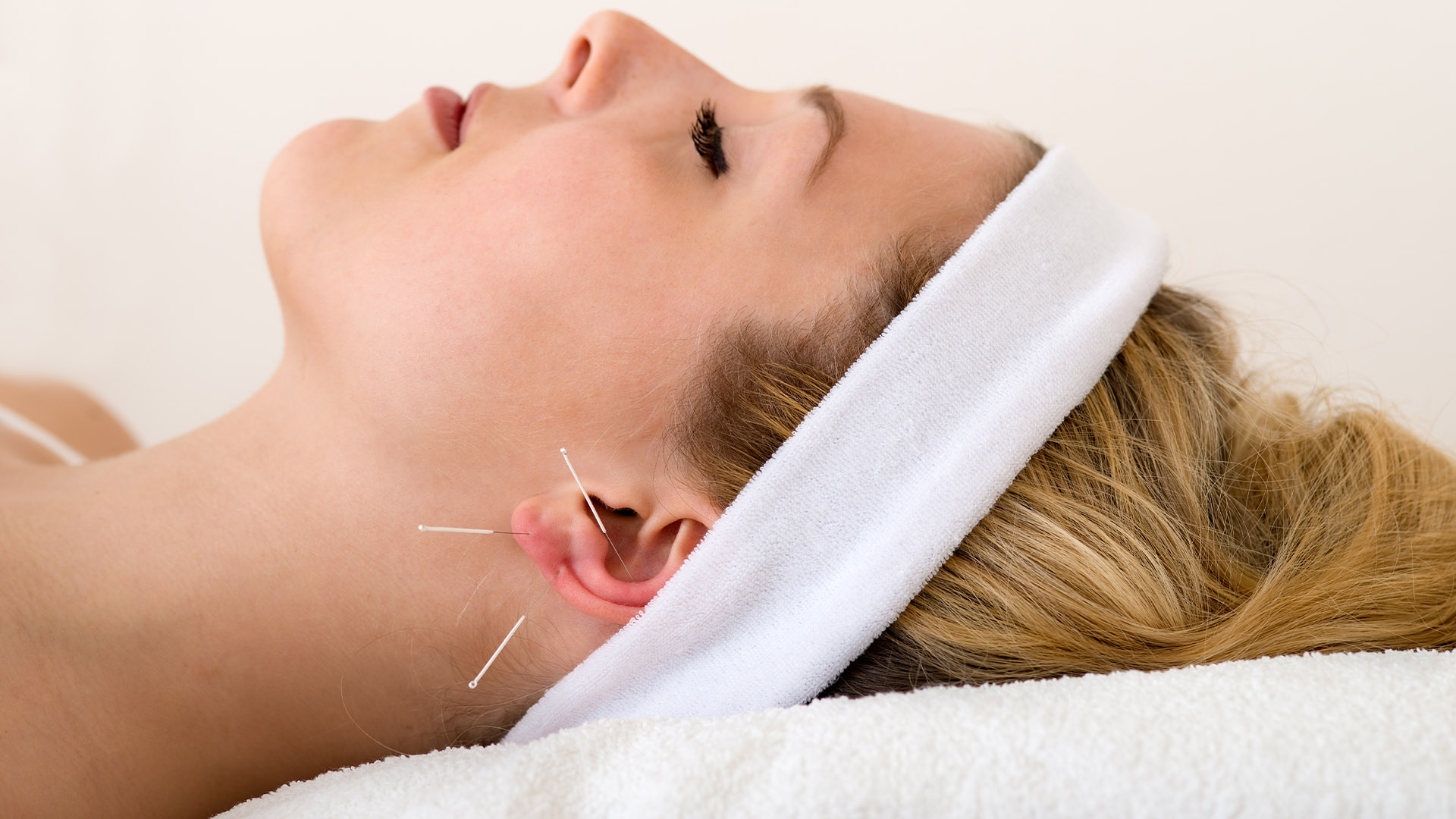 Auriculotherapy or Ear Acupuncture
