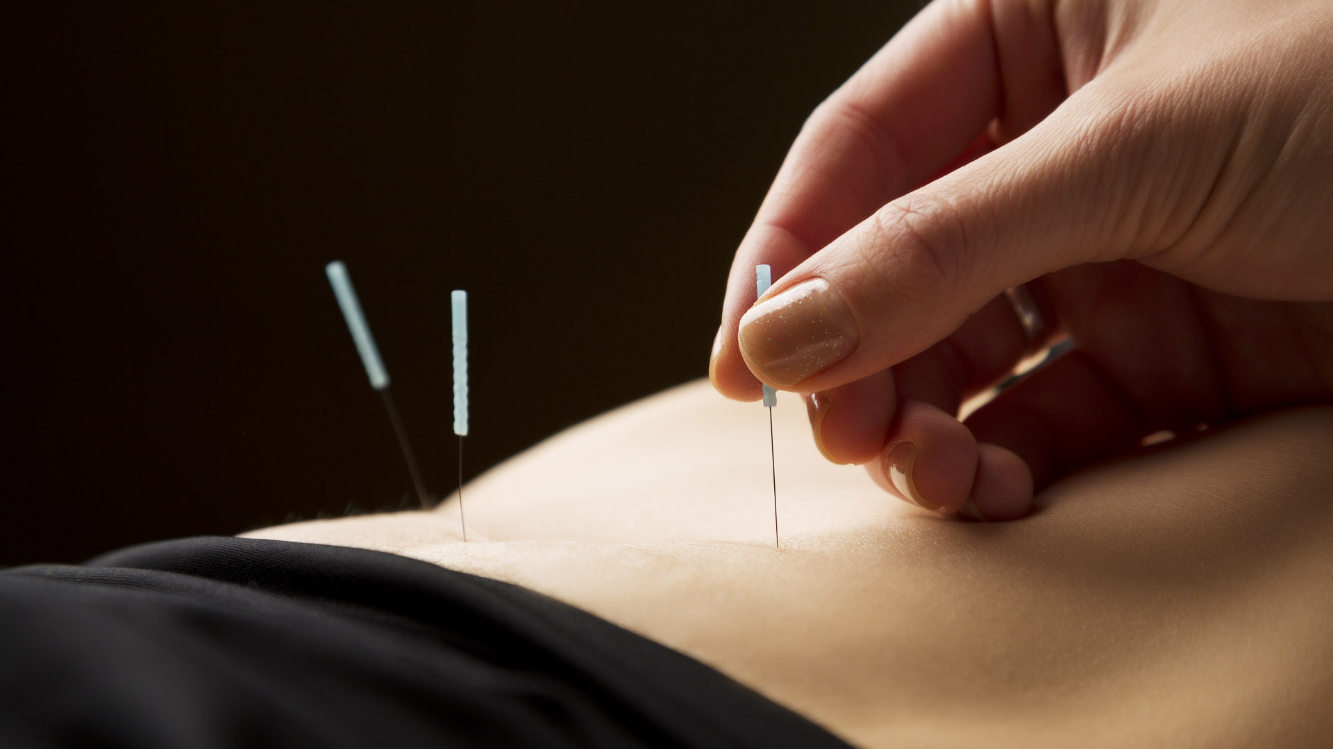 Acupuncture for Urinary Issues