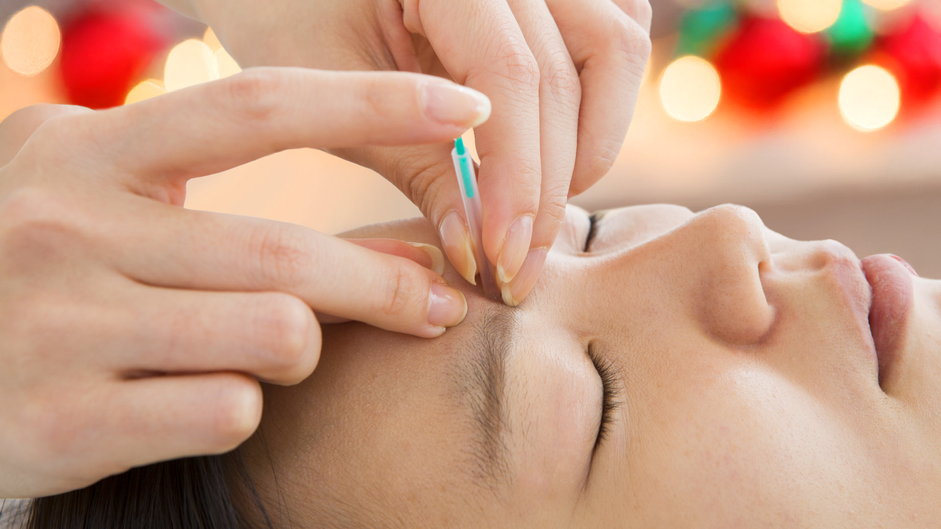 cosmetic acupuncture la jolla